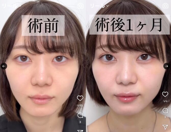 メイク前後の比較画像